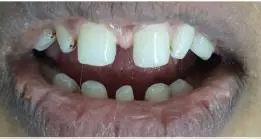 gallery-small-11-a gallery-small-11-a