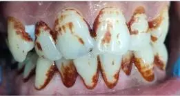 gallery-small-13-a gallery-small-13-a