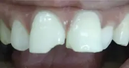 gallery-small-5-a gallery-small-5-a