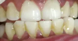 gallery-small-6-a gallery-small-6-a