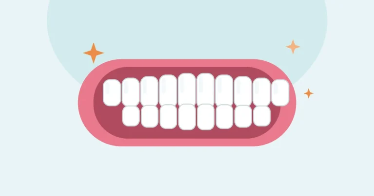 Illustration of a smile with a row of even white teeth and sparkles, for smile design and veneers