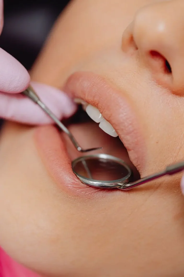Dentist examining gums with a dental mirror