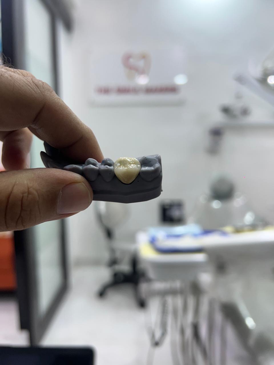 Zirconia crown held for a close view at The Smile Makers Dental Clinic, Khar West