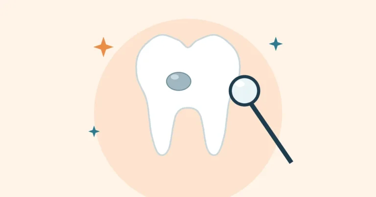 Illustration of a tooth with a filling and a dental mirror
