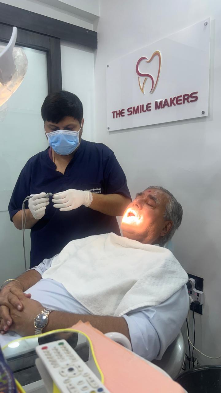 Implant placement by Dr. Manoj Bodhwani at The Smile Makers Dental Clinic, Khar West